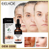 30ml Dark Spots Correcting Glow Serum Hydrating And Soothing Facial Essence Melanin Brightening Face Serum For Sensitive Skin