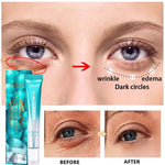 7 Days Magical Anti-Wrinkle Eye Cream Fade Fine Lines Anti Dark Circles Serum Remove Eye Bags Puffiness Anti-Aging Firm Eye