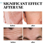 Collagen Anti-Wrinkle Cream for Men Instant Firming Lift Anti Aging Remove Eye Bag Fine Lines Nourish Moisturize Face Skin Care