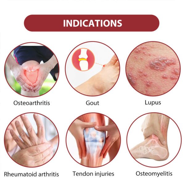 12 Pcs/2 Packs Magnetic Plaster Rheumatism Arthritis Medical Arthrophlogosis Bone Spur Joint Knee Shoulder Pain Relief Patch