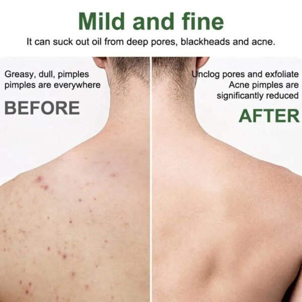 Men's Soap Essential Oil Soap Mite Removing Moisturizing Natural Bar Soap Deep Cleansing Pores Remove Dirt For Men Pine Tar Soap