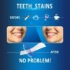 Teeth Whitening Strips 14 Treatments - Non-Sensitive Enamel Safe Whitening Strips - Whiter Smile in 30 Mins without Harm - Tooth Stains Removal to Whiten Teeth - 10 Shades Whiter - 28 Strips
