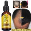 Ginger Hair Growth Essential Oil Fast Growing Products Natural Anti Hair Loss Prevent Hair Dry Frizzy Damaged Repair Care