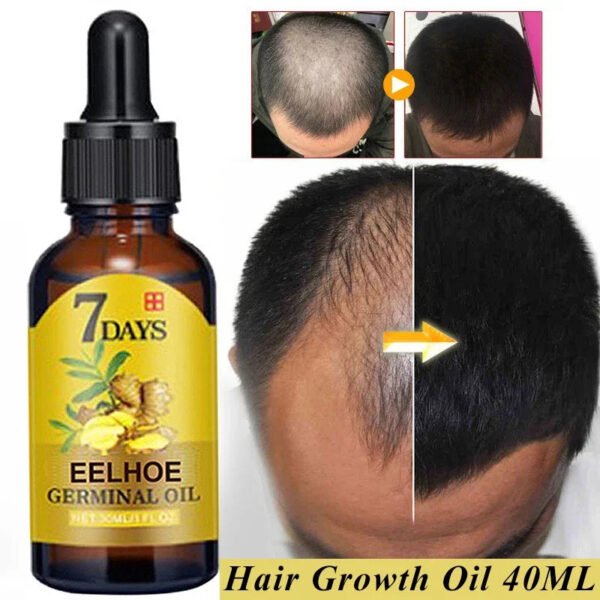 Ginger Hair Growth Essential Oil Fast Growing Products Natural Anti Hair Loss Prevent Hair Dry Frizzy Damaged Repair Care