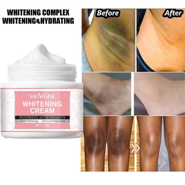 Body Whitening Cream Intimate Areas Underarm Knee Buttocks Private Bleach Remove Melanin Pigmentation Nourish Dark Skin Brighten