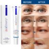 Eye Cream Instant Anti Aging Remove Dark Circles Wrinkle Removal Bags Puffiness Fade Eye Fine Line Skin Face Tighten Korean Care
