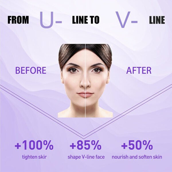 Firming Face-lift Slimming Cream V-Shape Slimming Removal Masseter Muscle Double Chin Face Fat Burning Anti-Wrinkle Products 30g