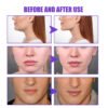 Firming Face-lift Slimming Cream V-Shape Slimming Removal Masseter Muscle Double Chin Face Fat Burning Anti-Wrinkle Products 30g