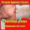 Scar Removal Cream Old Scar Cream Effective Repair New Scars Surgical Scars Stretch Marks Acne Pits Acne Marks Burn Scars
