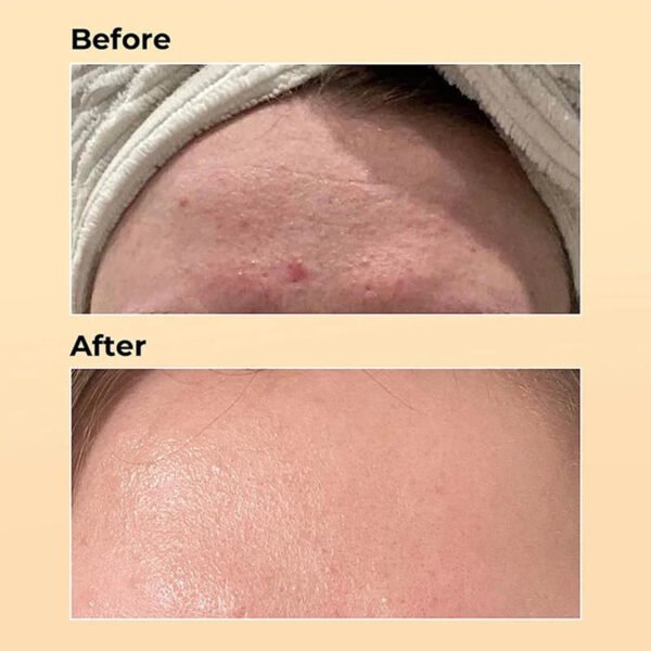 100ml COSRX Snail Mucin 96% Power Anti-aging Fade Fine Lines Repairing Essence Lift Firm Acne Treatment Facial Care Products